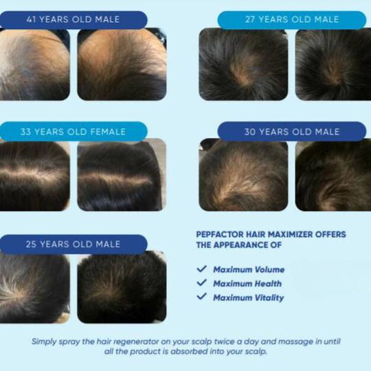 Pepfactor Hair & Scalp Maximizer image 1